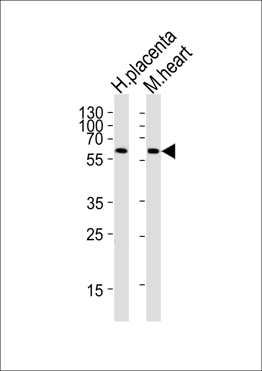 1 - PPARG Antibody (N-term) AP20705a