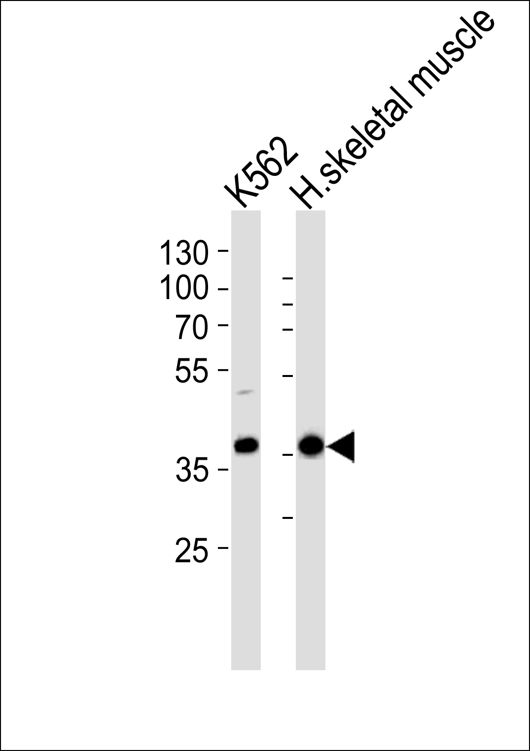 1 - TF2H2 Antibody AP50741