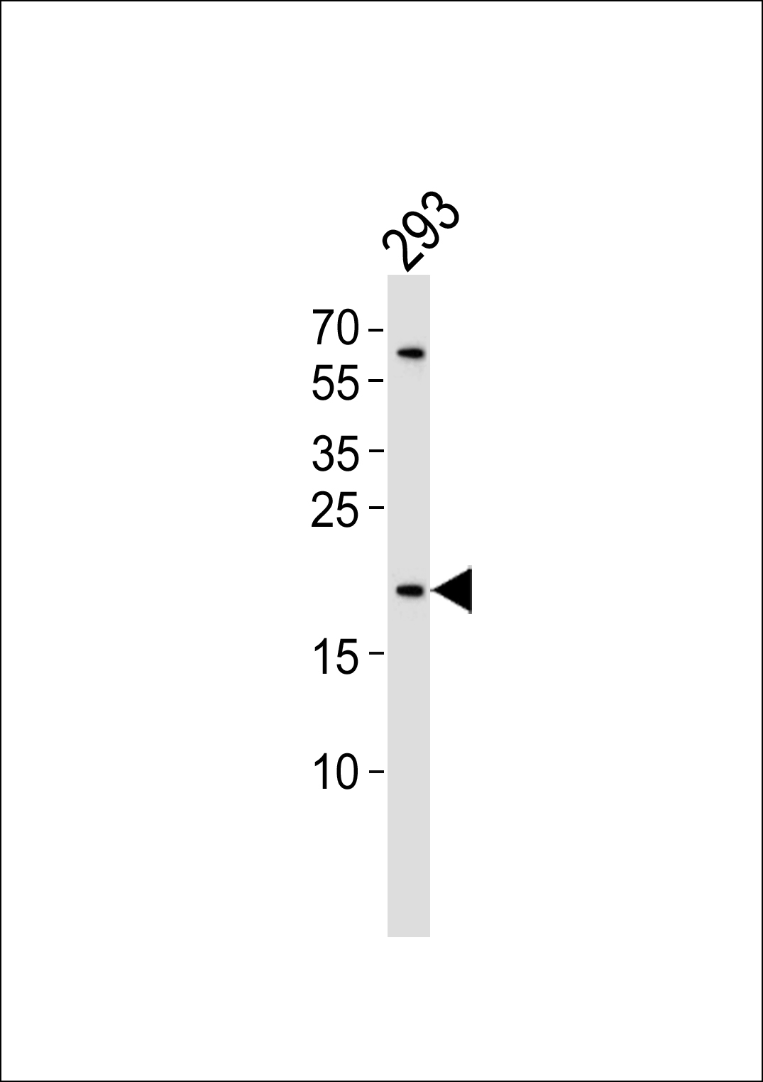 1 - BAX Antibody AP50746