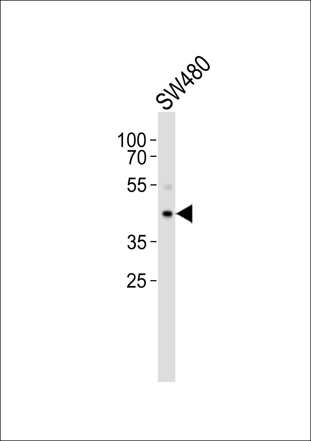 1 - POU4F1 Antibody AP50748