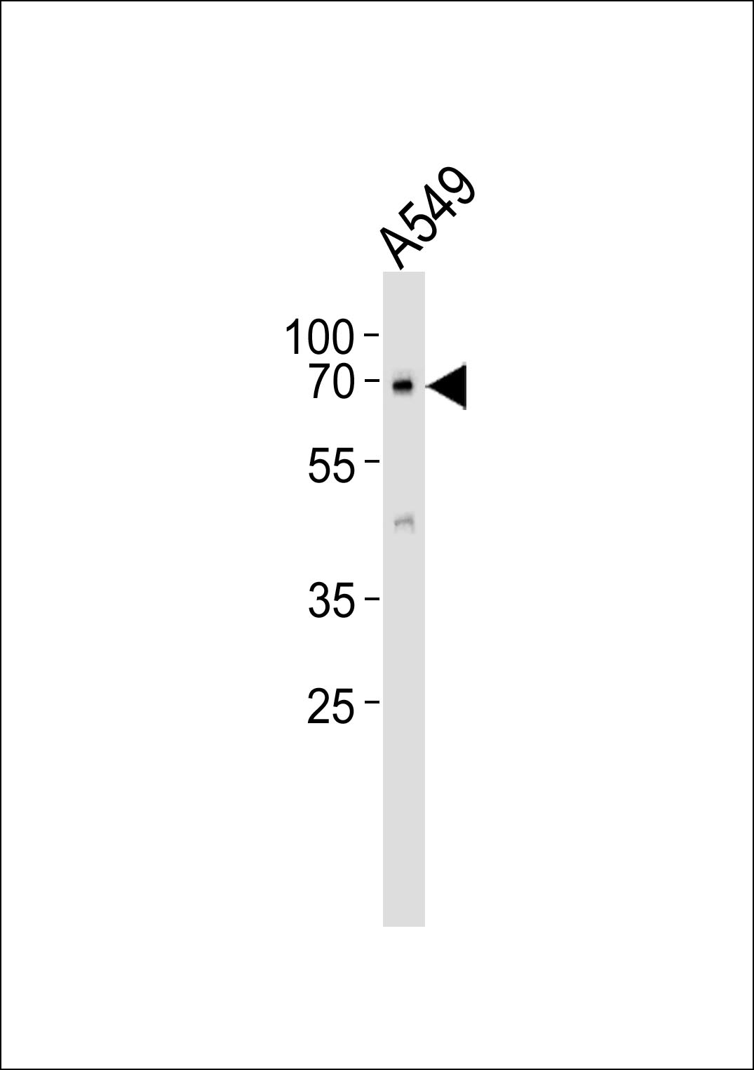 1 - GPC5 Antibody AP50755