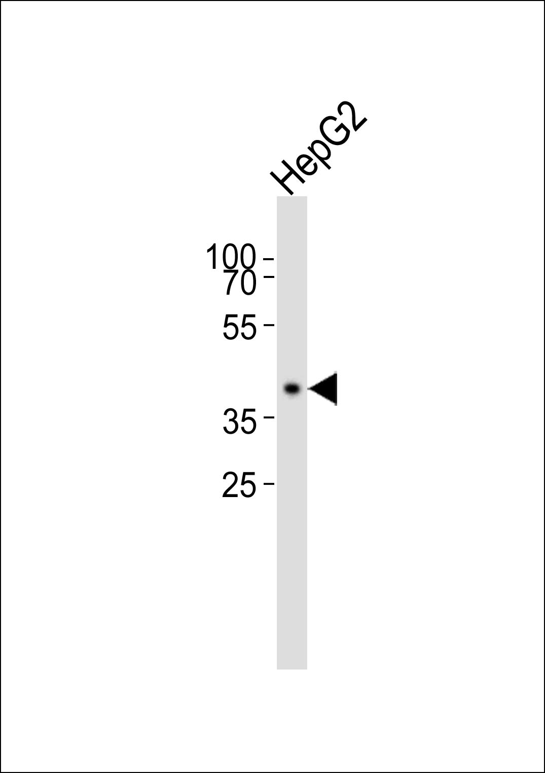 1 - MRPS22 Antibody AP50756