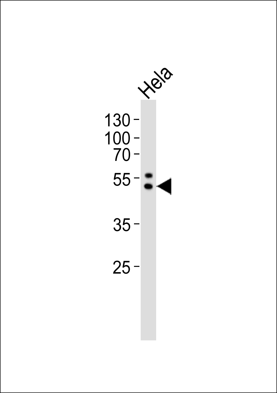 1 - PTRF Antibody AP50762