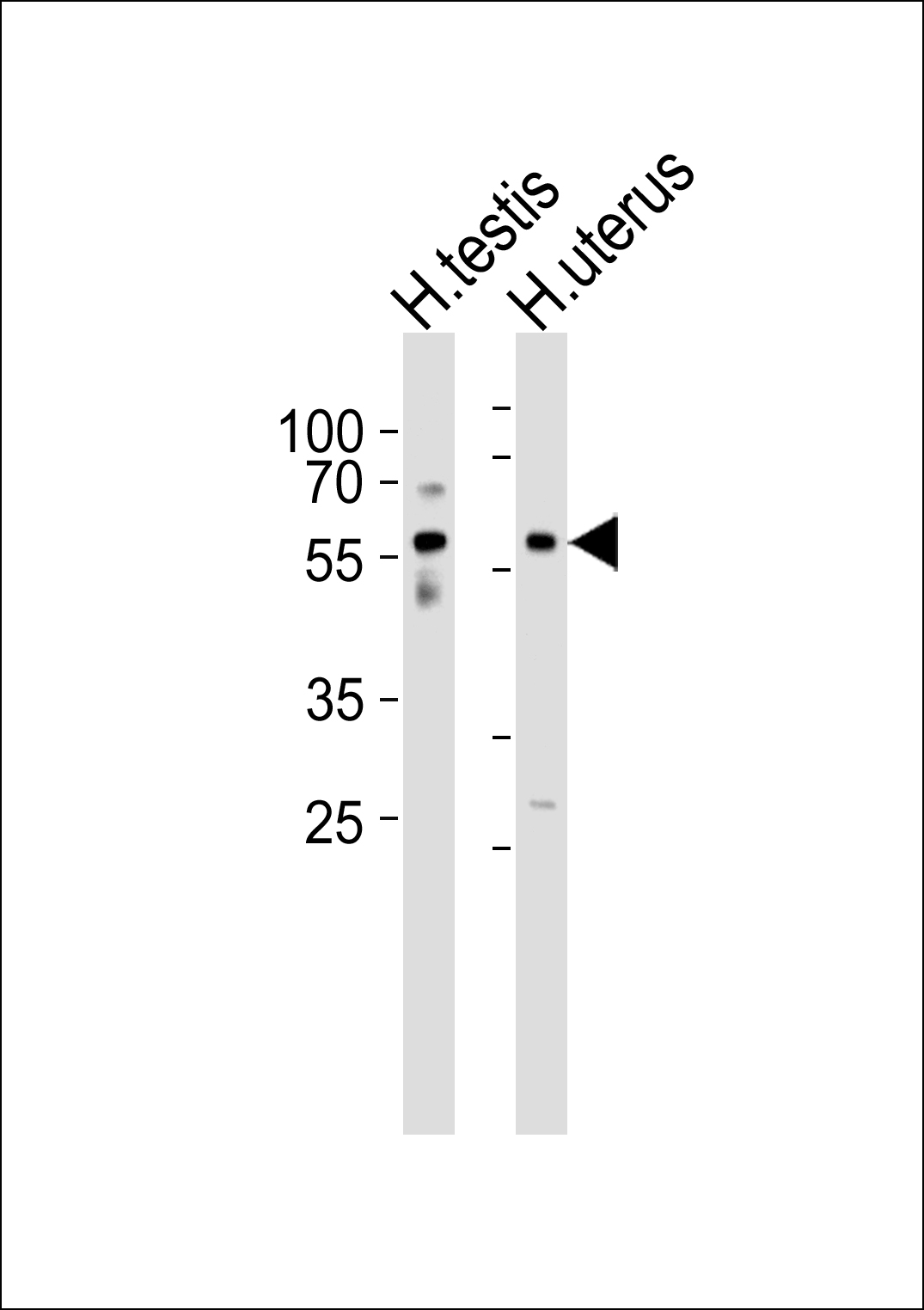 1 - B3GALTL Antibody AP50766