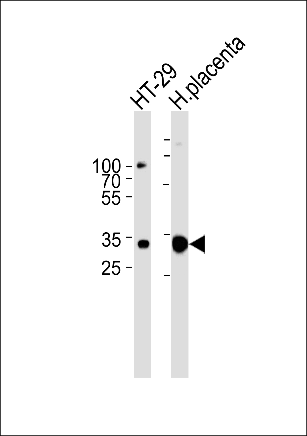 1 - GJB7 Antibody AP50767