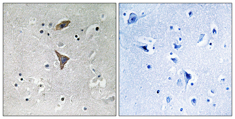 2 - KCNT1 Antibody AP50772