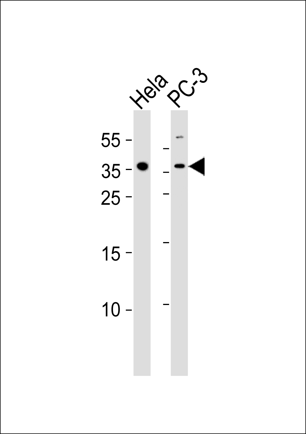 1 - GUSBL1 Antibody AP50782
