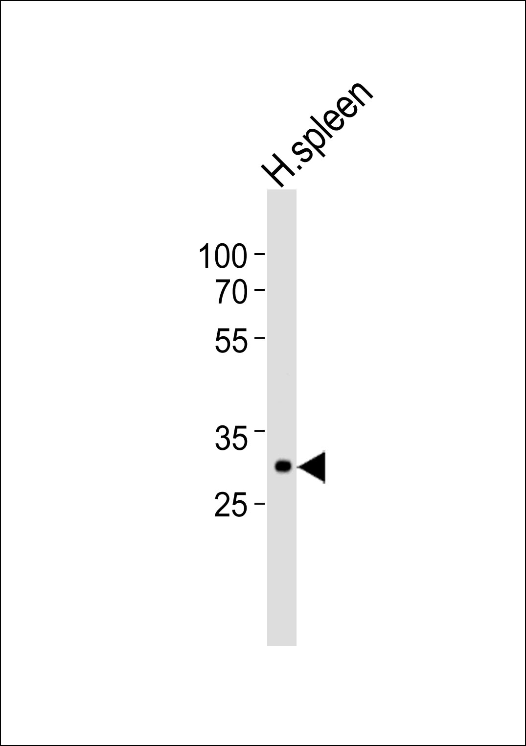 1 - SPIC Antibody AP50791