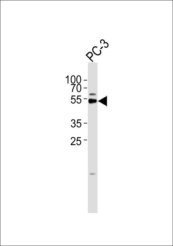 1 - TAIP-2 Antibody AP50827