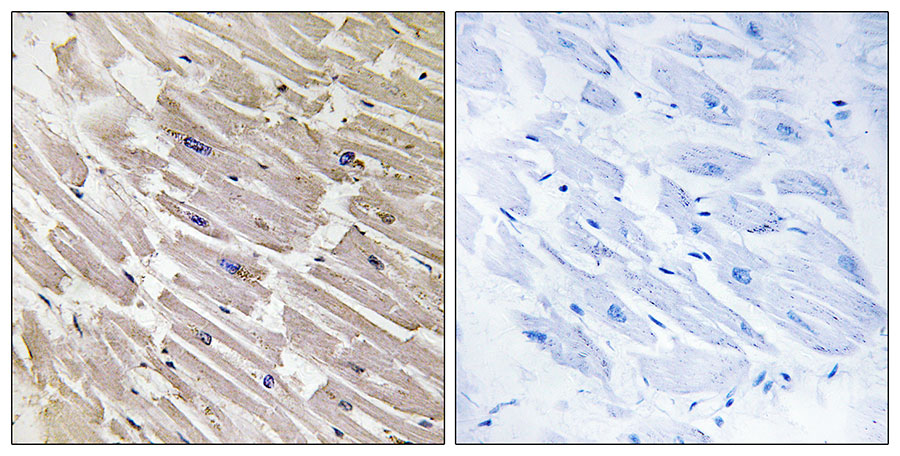 2 - MRPL16 Antibody AP50844