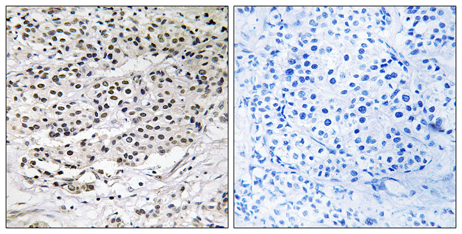 2 - AZI1 Antibody AP50845