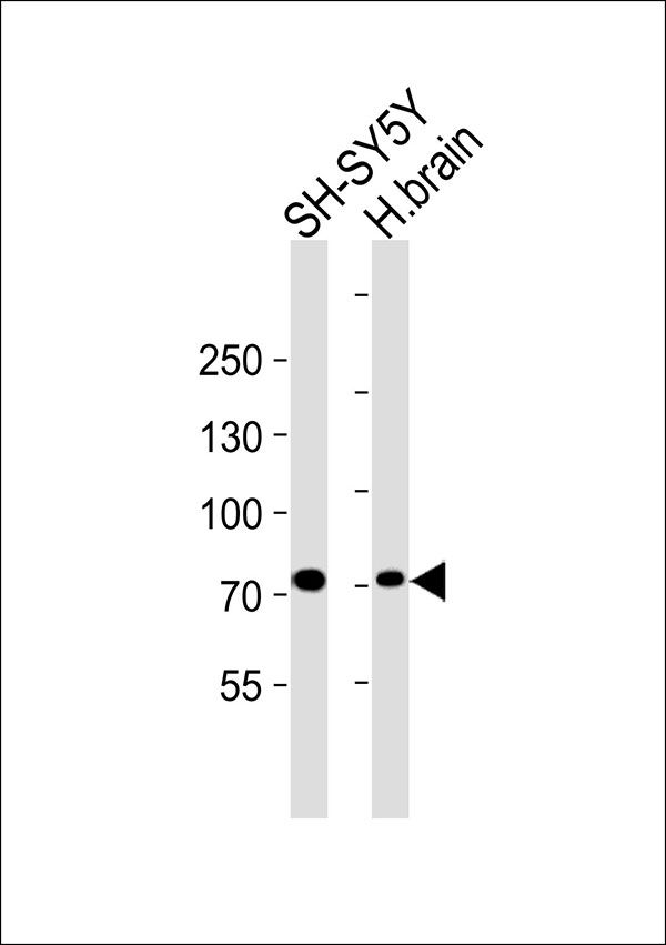 1 - ARPP21 Antibody AP50846