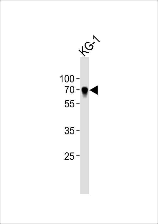 1 - IKZF2 Antibody AP50853