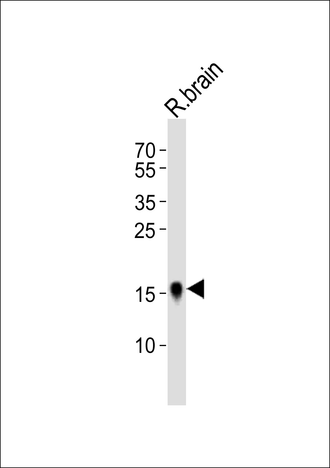 1 - FXYD1 Antibody (C-term) AP20771c