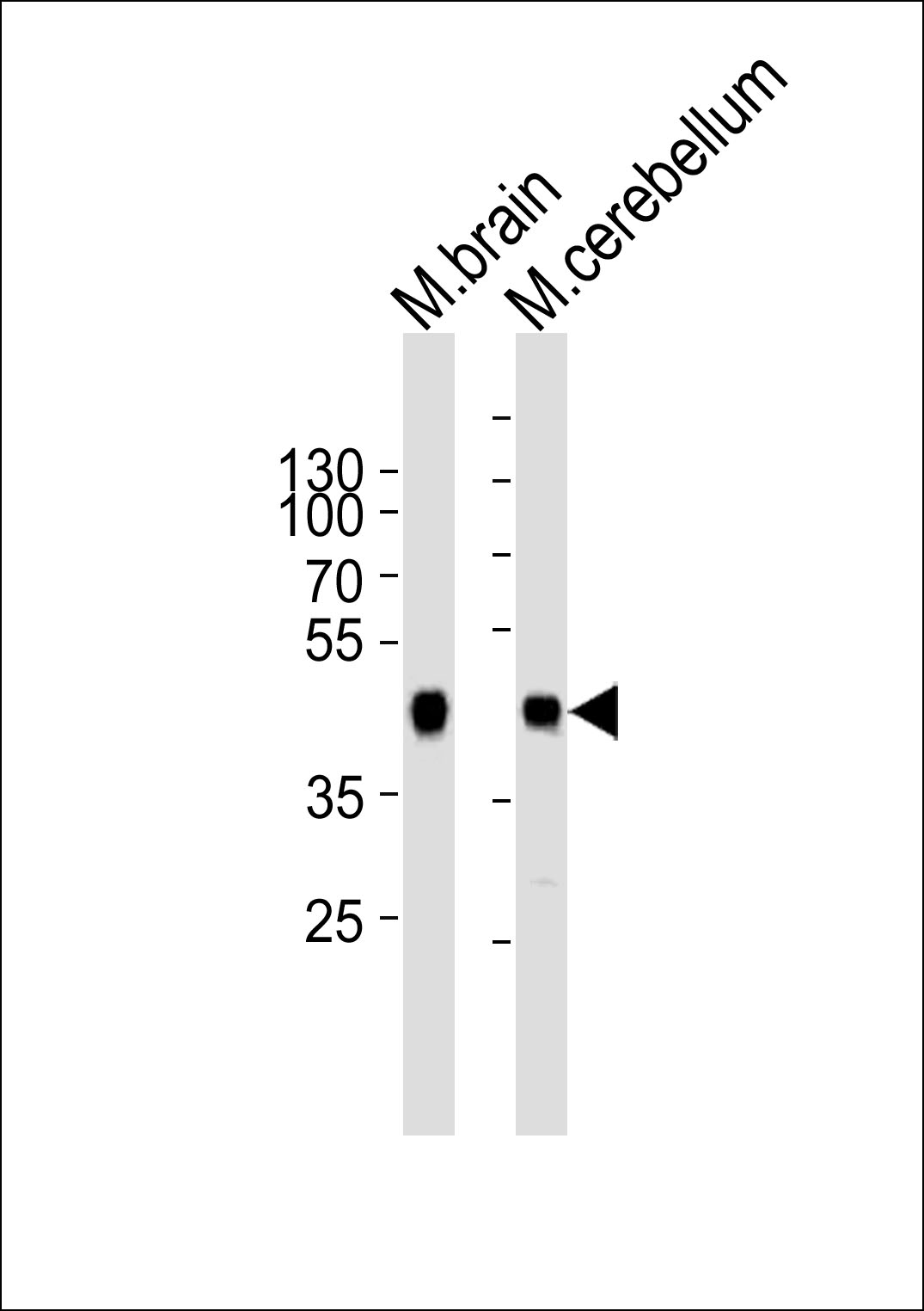 1 - ZDHHC14 Antibody (Center) AP20773c