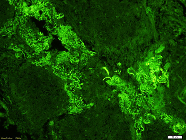 3 - Fibrinogen beta chain Antibody AP50861
