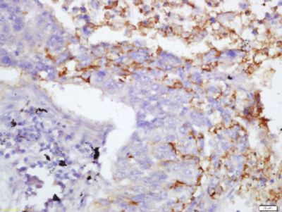 2 - Fibrinogen beta chain Antibody AP50861