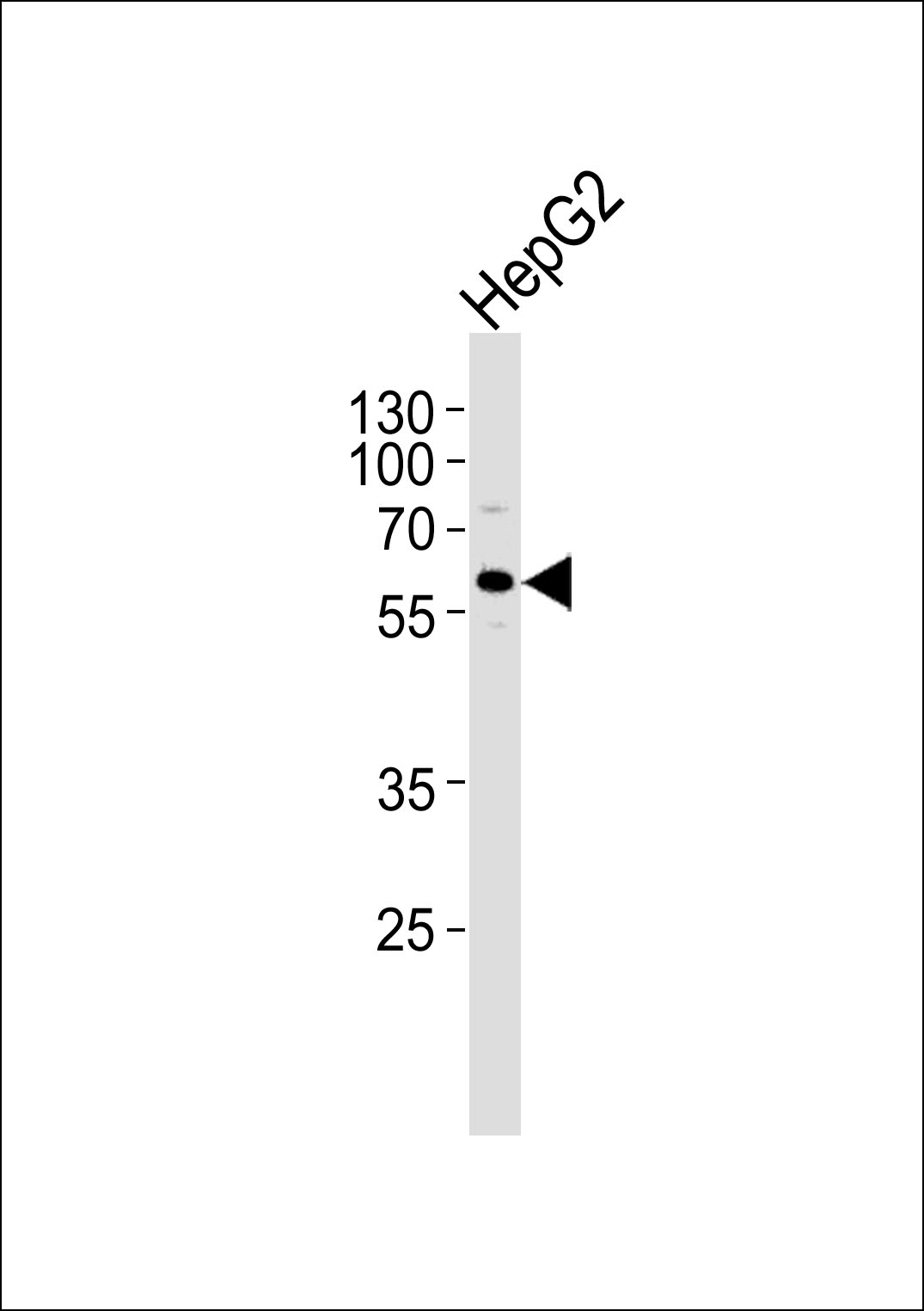 1 - Fibrinogen beta chain Antibody AP50861