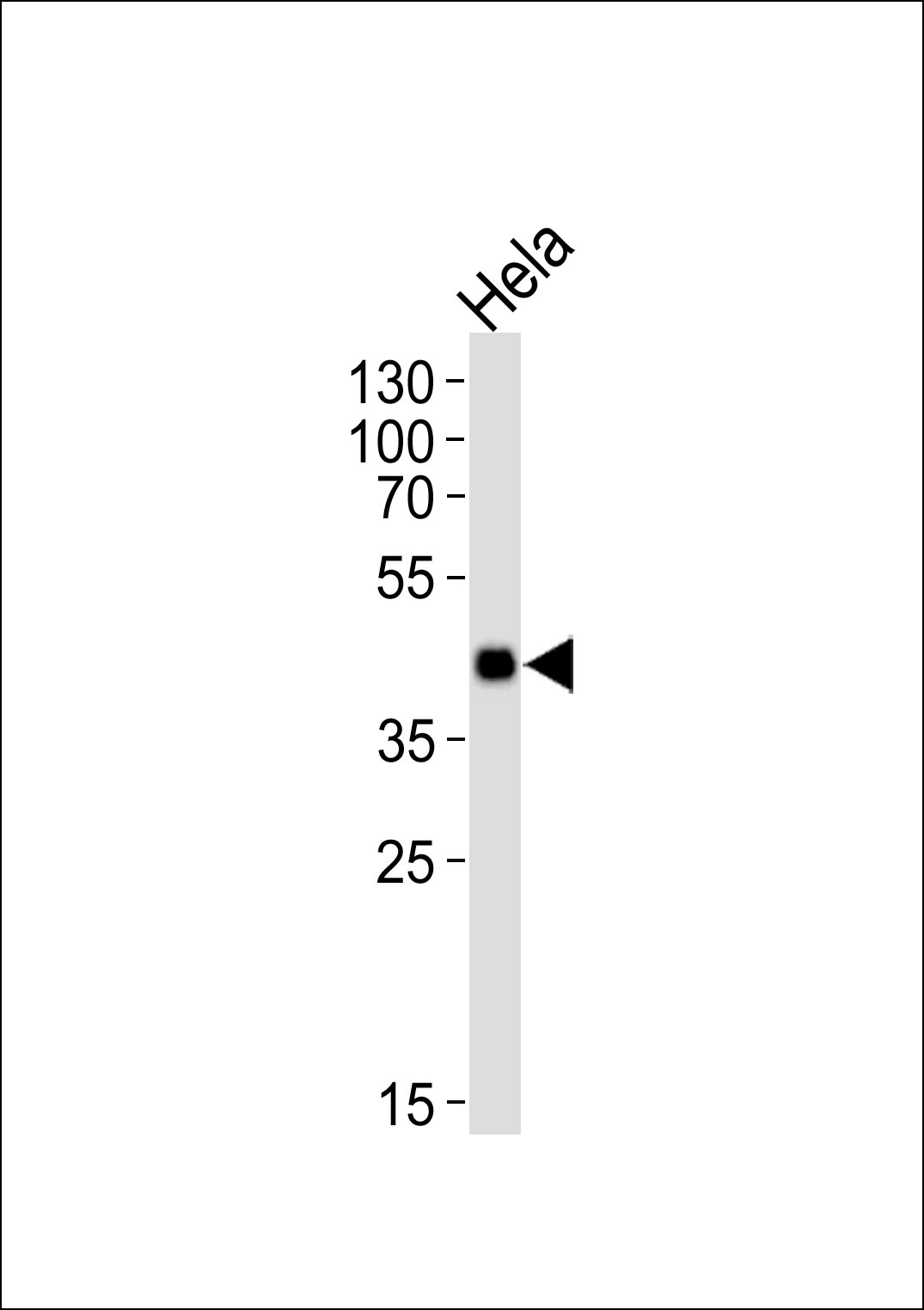 1 - Mouse Mapkapk3 Antibody (N-term) AP14268a
