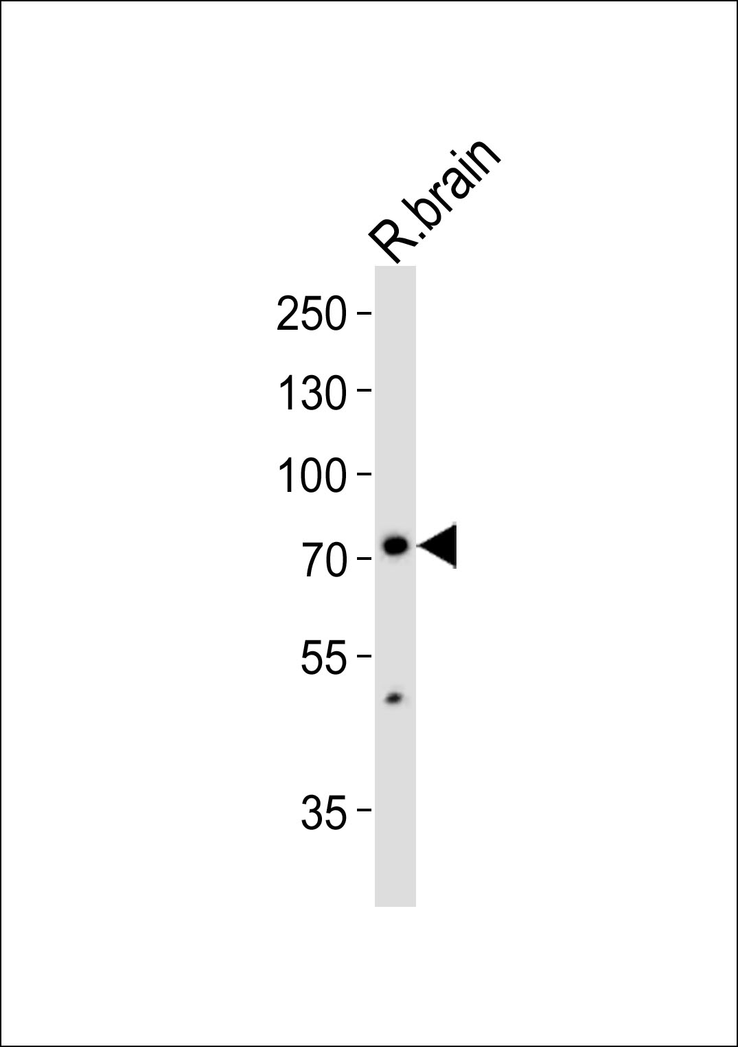 1 - SV2C Antibody (C-term) AP20824c