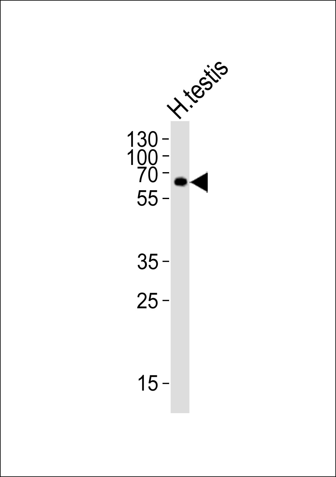 1 - ZIM2 Antibody (N-term) AP20833a