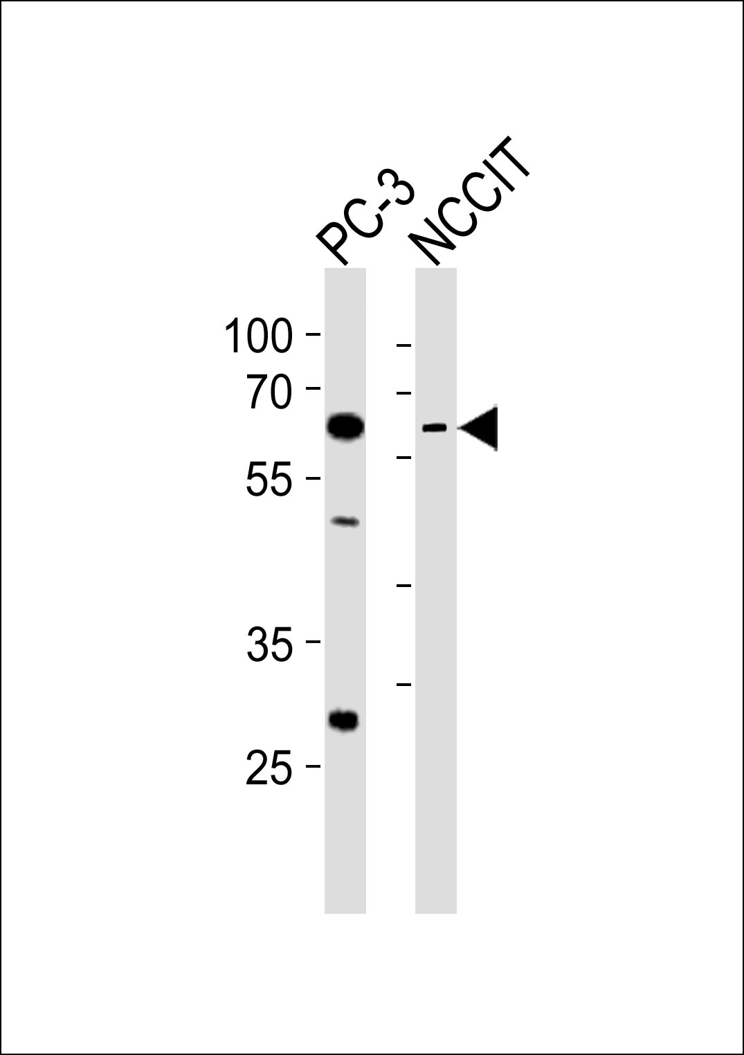 1 - TBX22 Antibody (C-term) AP20844c