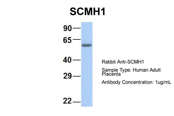 1 - SCMH1 antibody - middle region AI10028