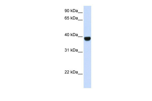 1 - FOXE1 antibody - middle region AI10029