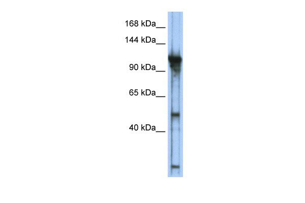 1 - GTF3C2 antibody - middle region AI10034