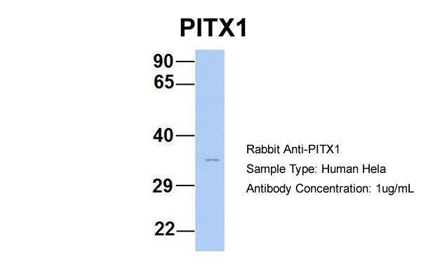 1 - PITX1 antibody - N-terminal region AI10047