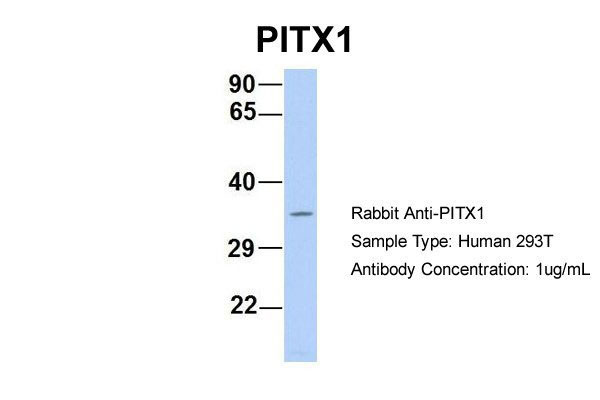 1 - PITX1 antibody - N-terminal region AI10047