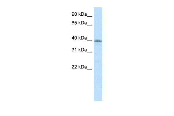 1 - NEUROD6 antibody - N-terminal region AI10058