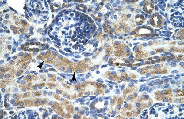 2 - ZNF24 antibody - middle region AI10092