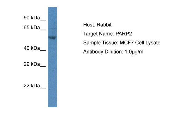 1 - PARP2 Antibody - C-terminal region AI10104