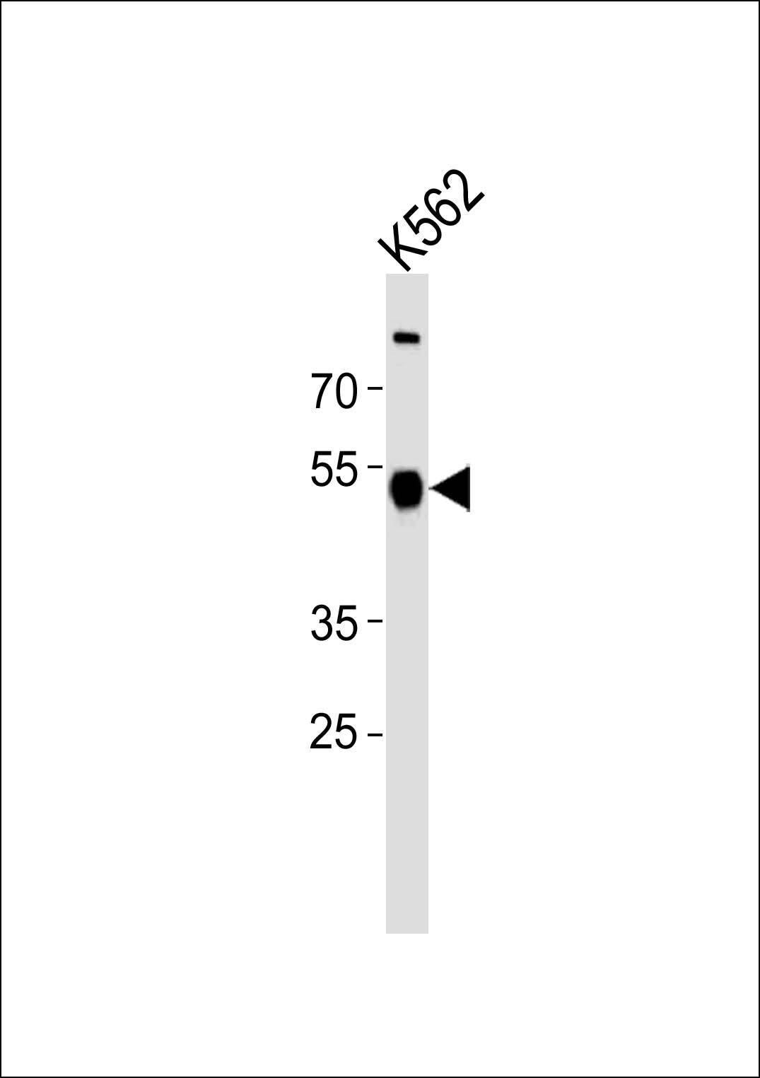 1 - ZNF500 Antibody (N-term) AP19018A