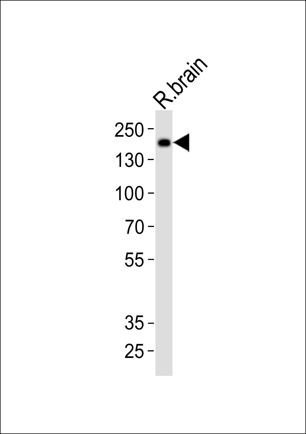 1 - Mouse Insrr Antibody (C-term) AP20858c