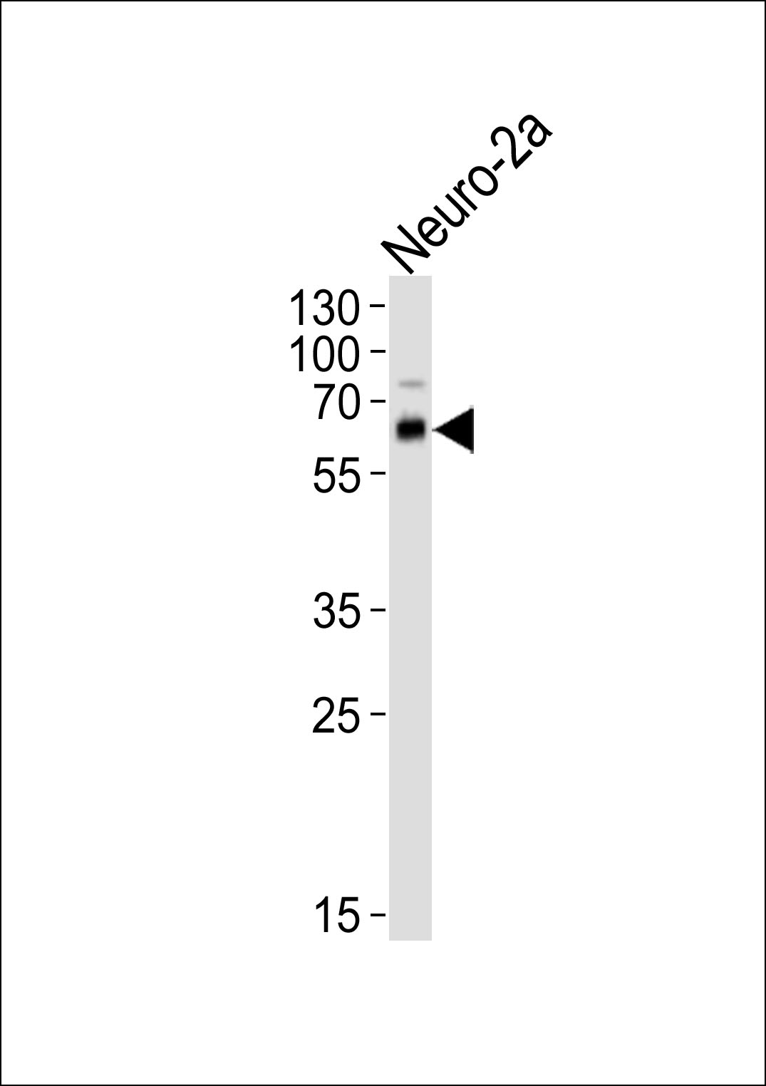 1 - PRKAA1/2 Antibody (N-term) AP20873b
