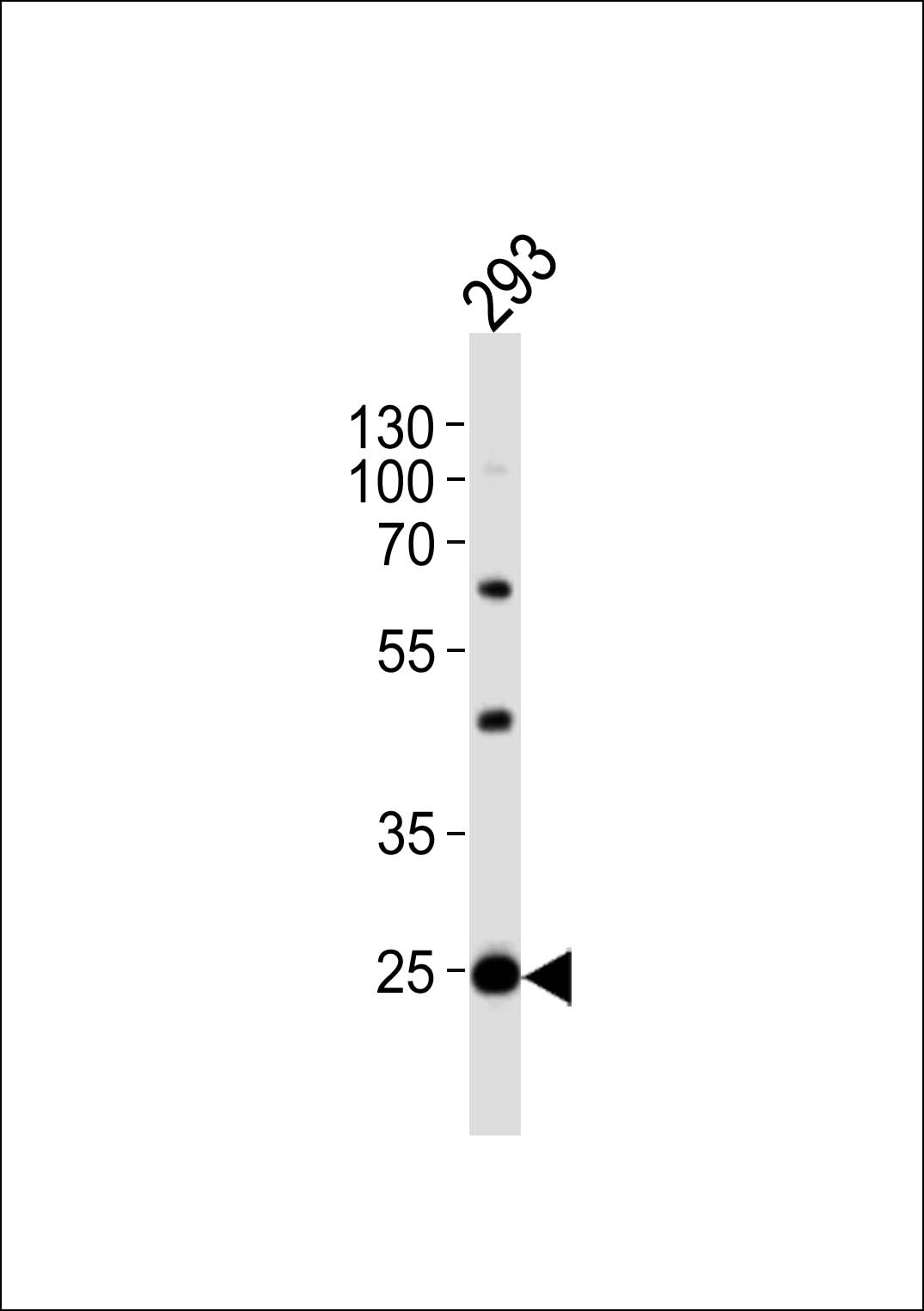 1 - BCAS2 Antibody (N-term) AP14509a