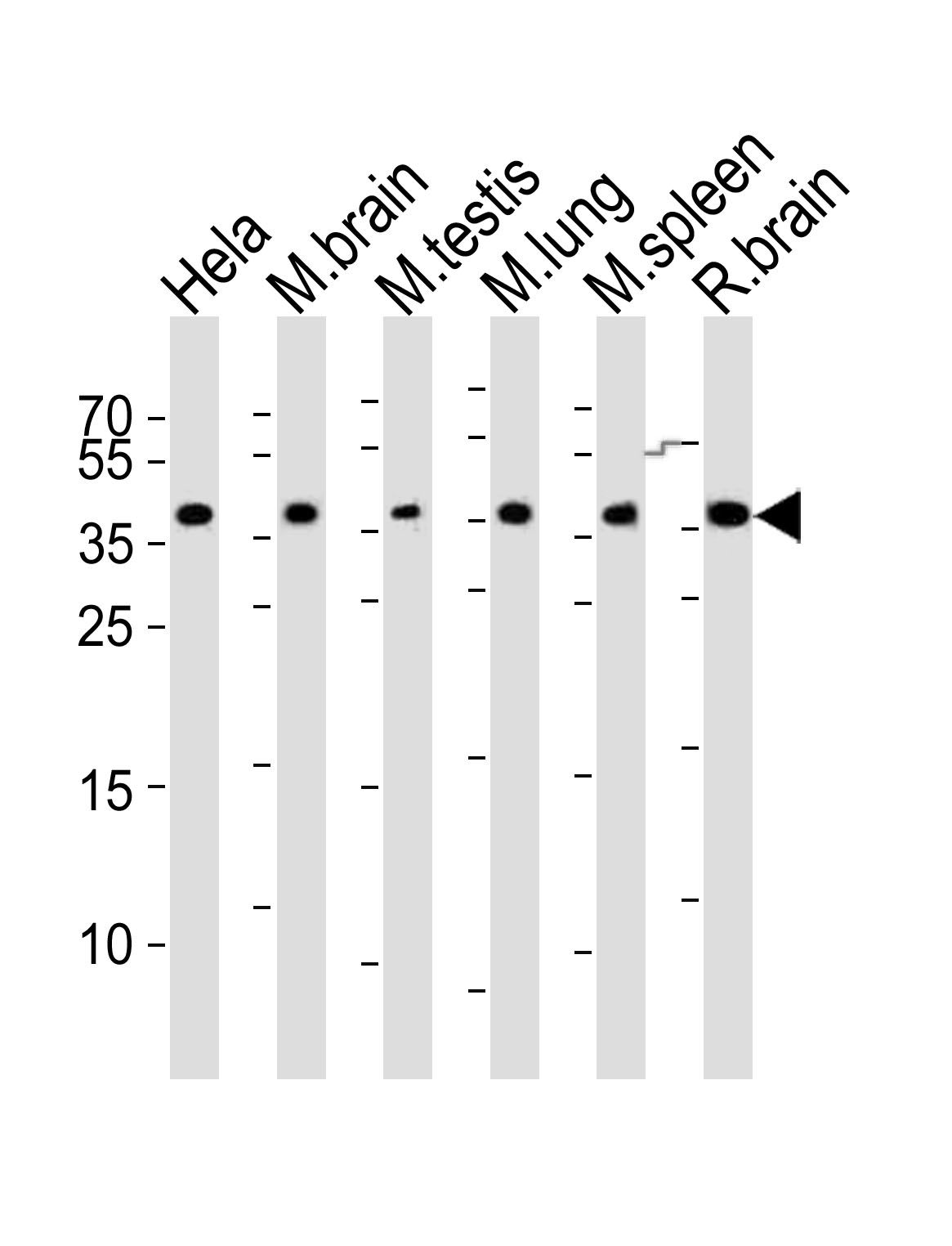 1 - Mouse Cbx7 Antibody (C-term) AP20840c