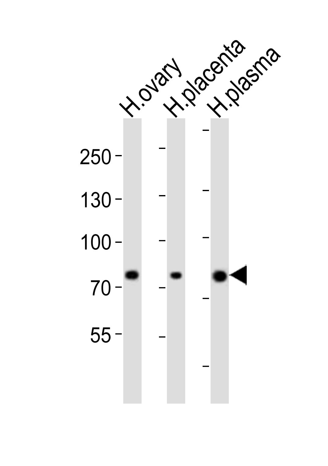 1 - ITGB8 Antibody (Center) AP21056a