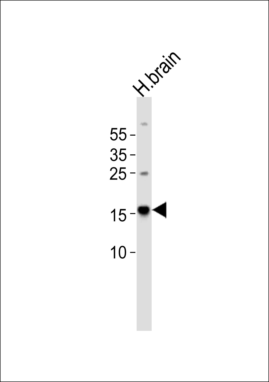 1 - (DANRE)  map1lc3a Antibody (C-Term) AP21075a