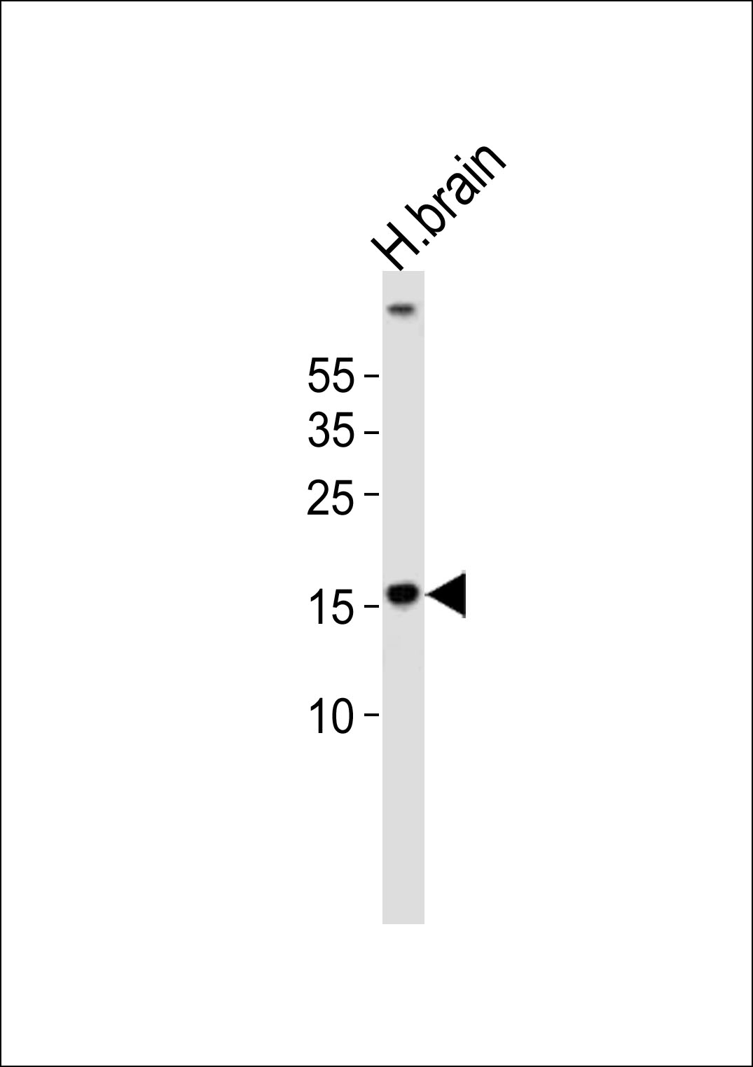 1 - (DANRE)  map1lc3a Antibody (N-term) AP21076a