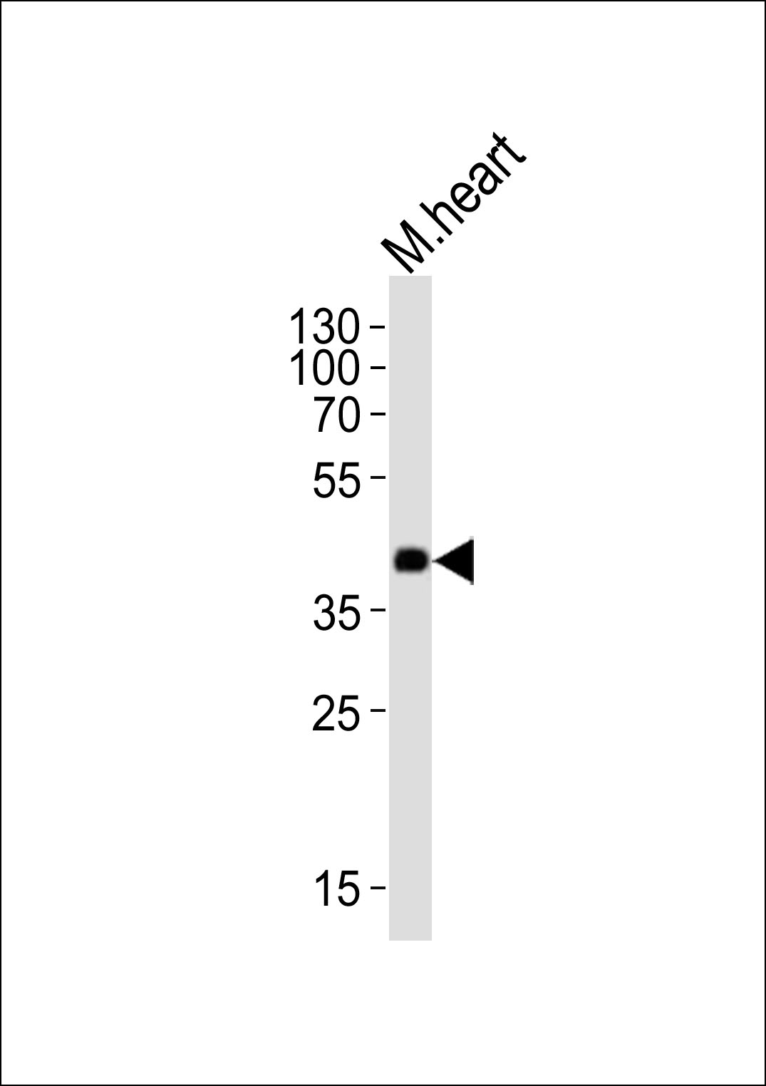 1 - Mouse Dnmt3l Antibody (Center) AP21127a