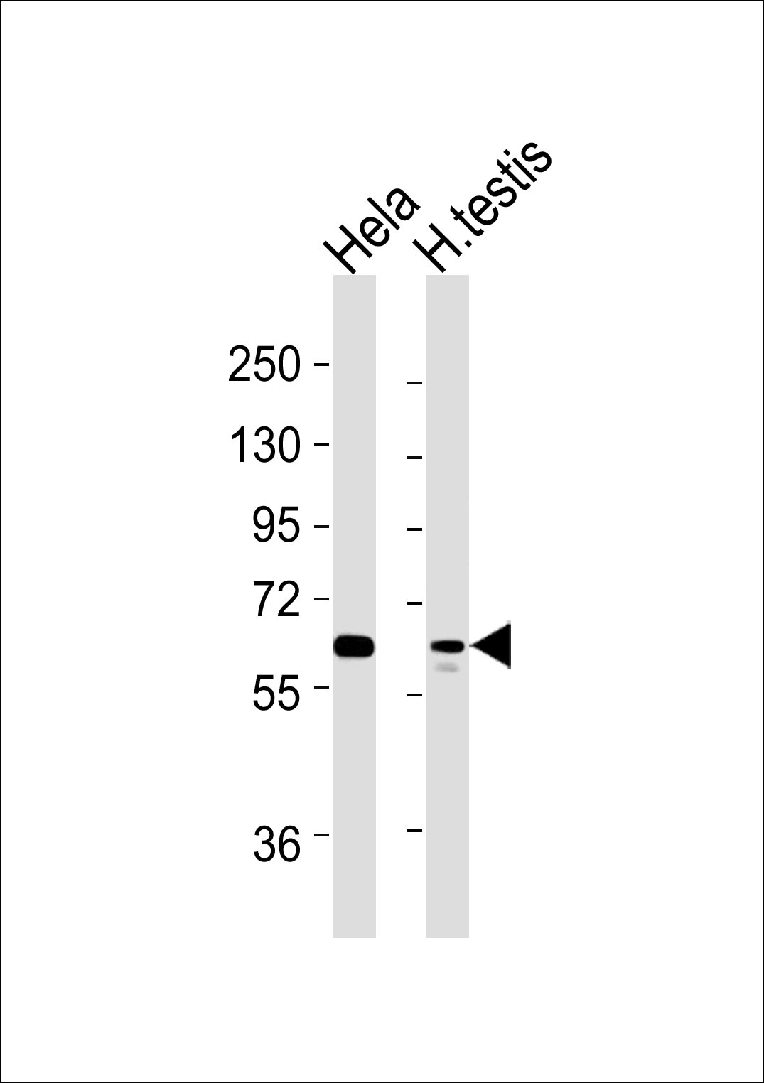 1 - Artemis (pS516) Antibody AP51158