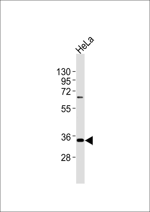 1 - NFYC Antibody AP51389