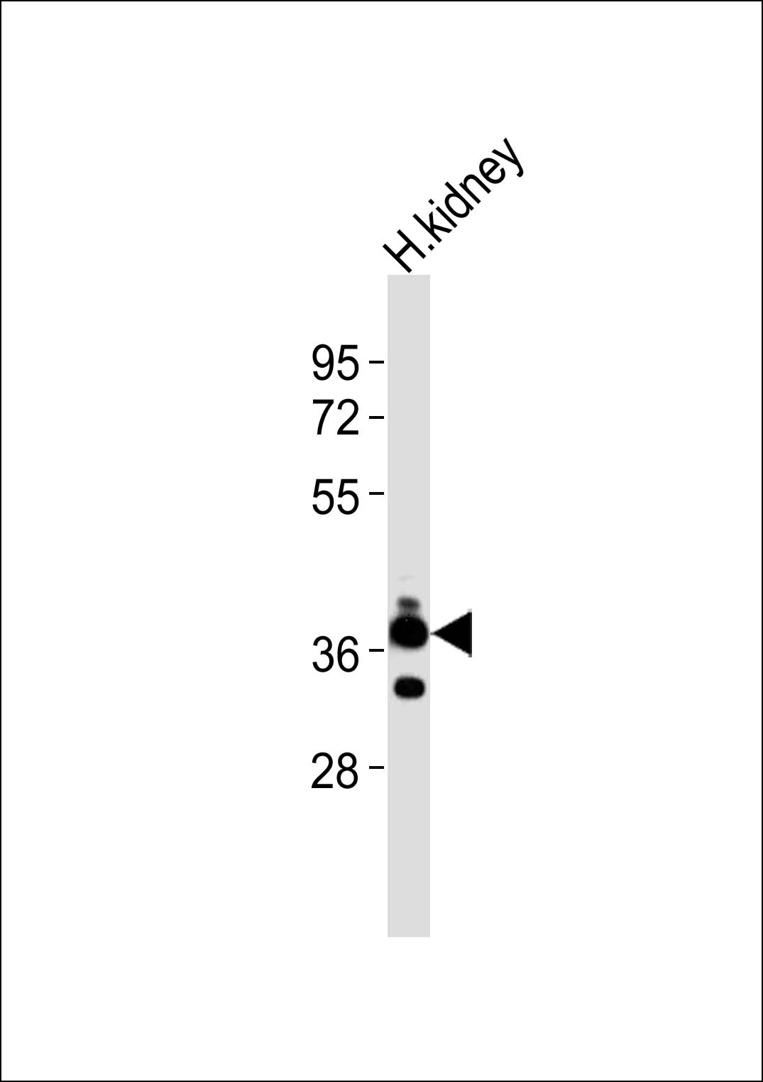 1 - CD157 Antibody AP51717