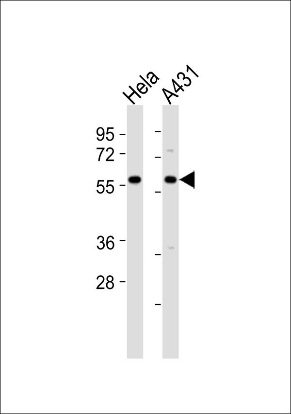 1 - TCP1 theta Antibody AP51872
