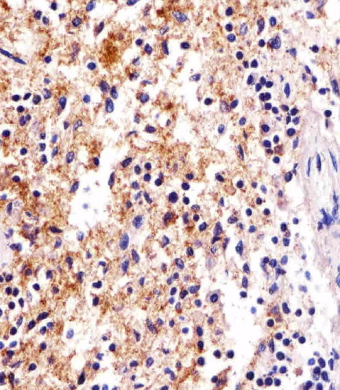 14 - FCER1G Antibody (C-term) AP19903b