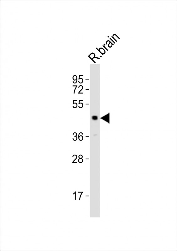 1 - LHX5 Antibody (Center) AP21158a