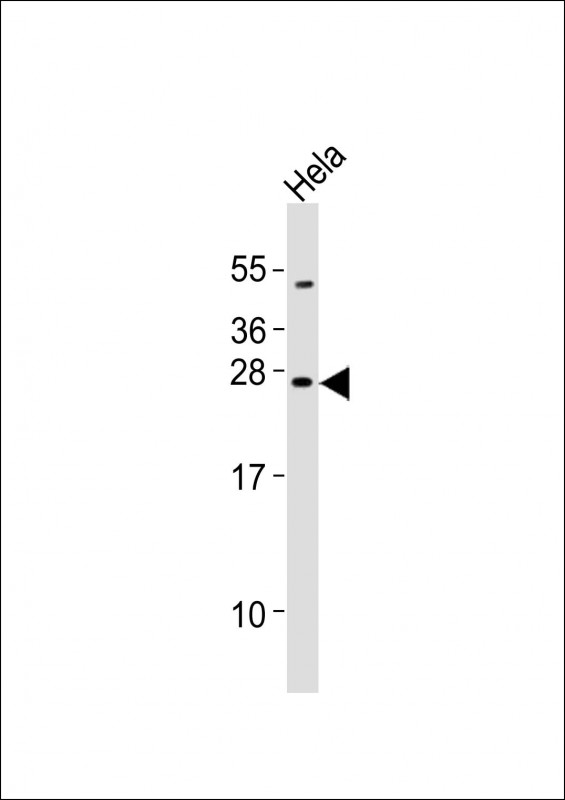 1 - Mouse Neurog2 Antibody (C-term) AP21257b